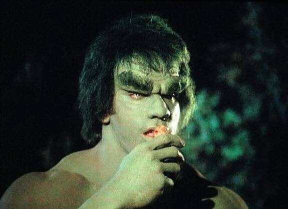 Legendární Hulk se po 43 letech rozvádí: Manželka trpící demencí přišla s drsným obviněním!