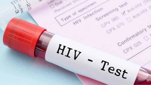 Mohu dostat HIV přes orální sex? / HIV | Užitečné informace a tipy na péči o sebe. Zdraví, výživa a další.