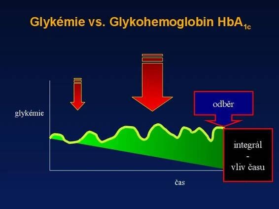 Glykovaný hemoglobin – absolutní parametr pro lékaře i pacienta | cukrovka
