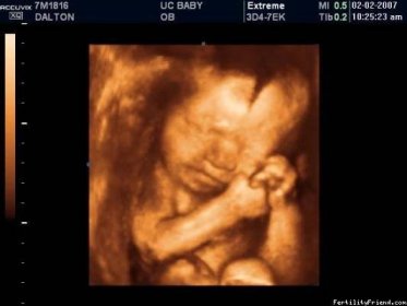 Fotografie z 3D ultrazvuku v 21. - 25. týdnu těhotenství