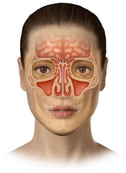Frontal Sinuses