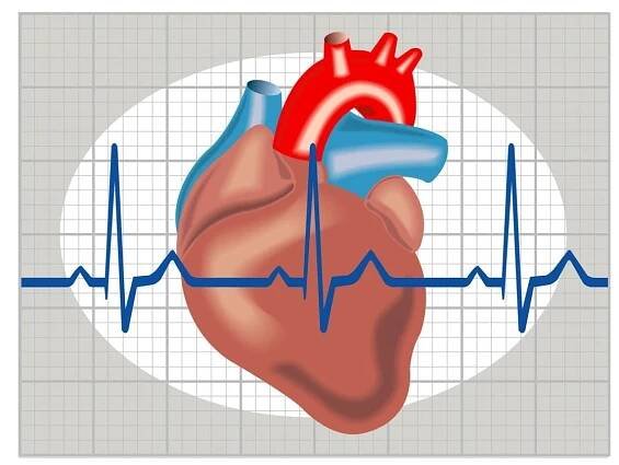 Cardioverter-Defibrillator: A Treatment for Arrhythmia - familydoctor.org