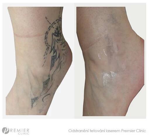 Reference - Premier Clinic