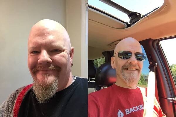 2014 vs 2015
