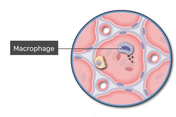 A lung alveolus with a macrophage labeled