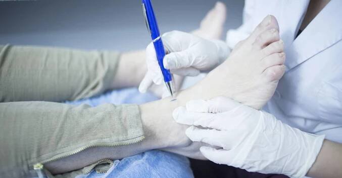 Bodavá bolest v nártu: Příčiny a možnosti léčby 2