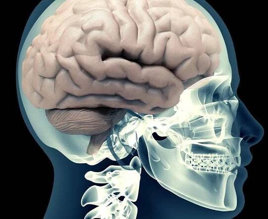 Intracerebral hemorrhage: Symptoms, risk factors, and treatment