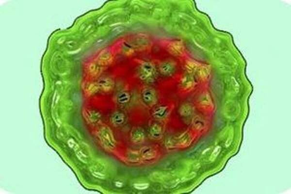 Virové hepatitidy D / Hepatitida
