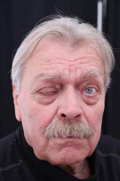 Manželka Josefovi (64) doslova zachránila kůži! Blesk Ordinace v Brně opět pomáhala