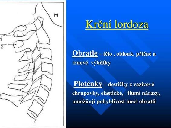 PPT - Krční páteř Degenerativní změny PowerPoint Presentation, free download - ID:1305907