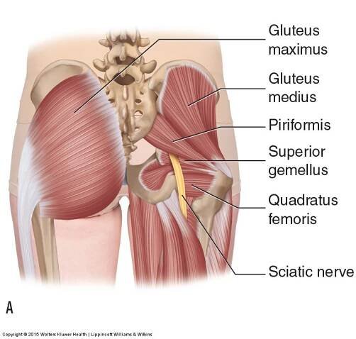 SYNDROM PIRIFORMIS