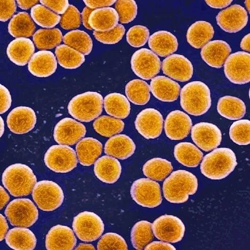 Superbugs evolve inside the human body — tracking them in real time could help save patients, scientists say