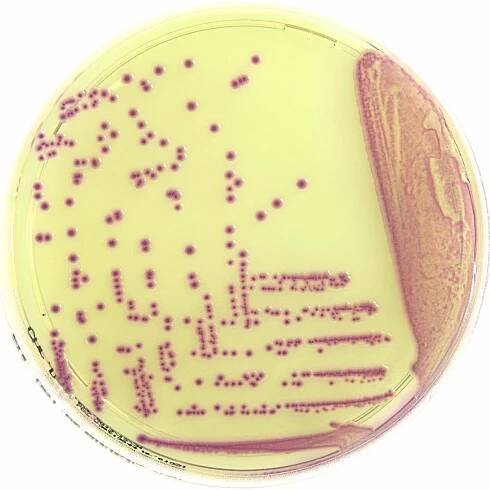 02. cre.e.coli_OK