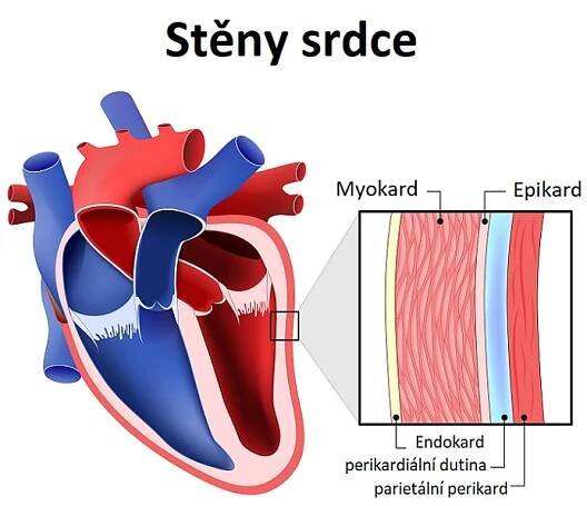 Endokarditida – zánět srdeční výstelky – příznaky, příčiny a léčba