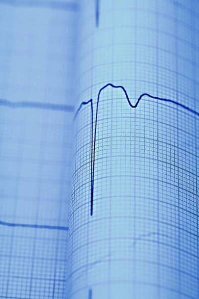 ekg makro jako lékařské diagnostické koncepty - fibrilace síní - stock snímky, obrázky a fotky