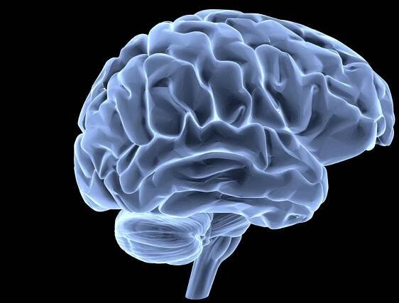 Untangling stroke and migraine - The Migraine Trust