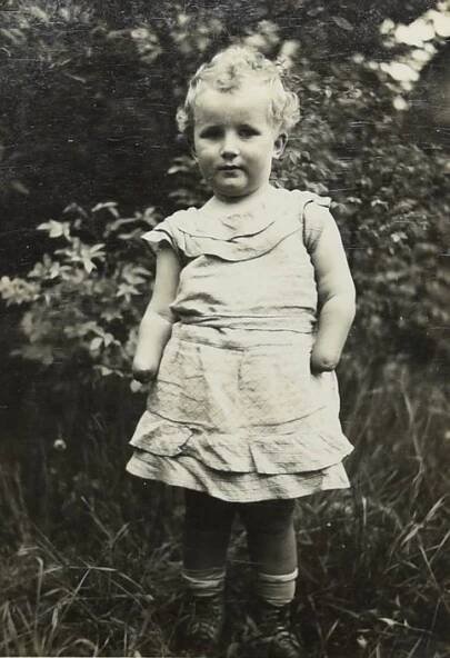Zemřela Anna Váchalová (†92): Matka jí uřízla obě ruce!