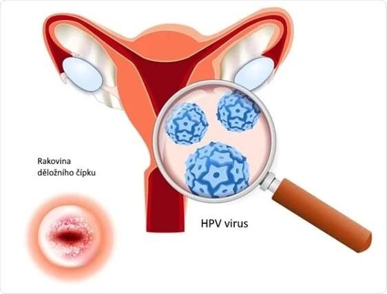 HPV
