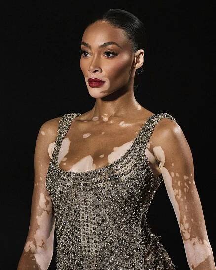Winnie Harlow ! | Lamodespot