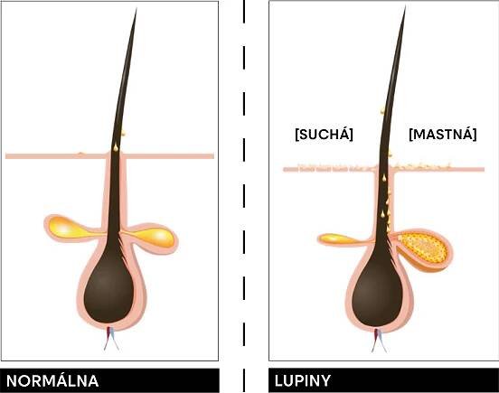 Scalp Advanced - řešení problémů vlasové pokožky • Friseurshop
