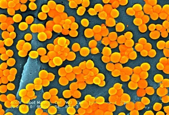 Staphylococcus Aureus Sem