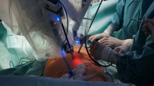 Operace tepny bez řezu skalpelem. Homolka drží světové prvenství v robotické cévní chirurgii