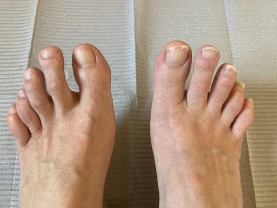 Wellness pedikúra Footlogix s masáží a lakováním za 1 200 Kč Štěpánovice Gabriela Königová GABOO - nehtové studio • Firmy.cz