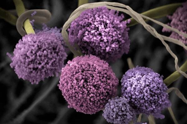 Lyme, SIBO, Candida, EBV in Mold Toxicity – Why won’t they go away? What do you do to get rid of them?