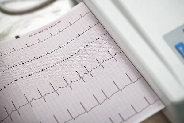 Causes and Treatments of Heart Murmurs