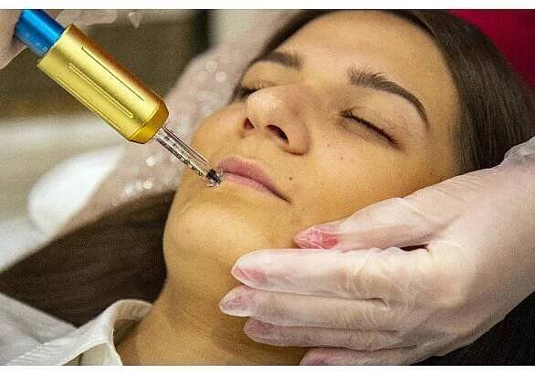 Hyaluron Pen - Beauty Studio FRESH LOOK na Praze 9 - Proseku