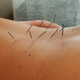 South Philly Community Acupuncture