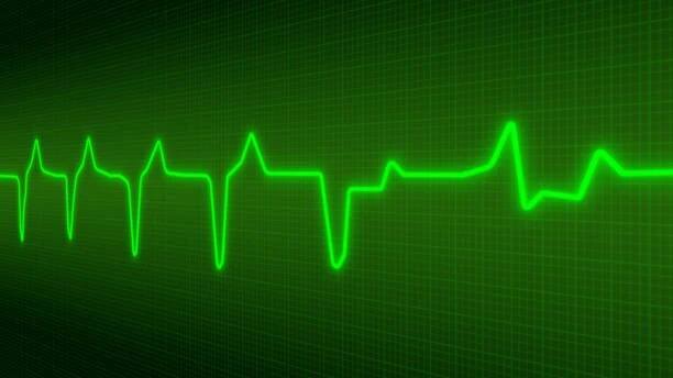 elektrokardiogram - courbe - stock snímky, obrázky a fotky