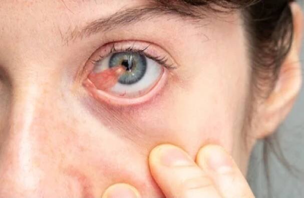 Bubble on Eyeball: Causes, Diagnosis & Treatment