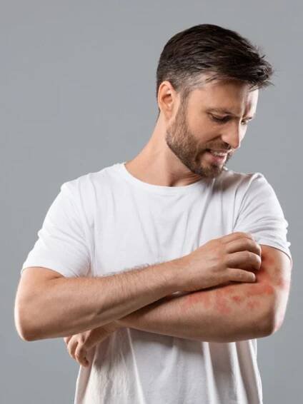 Biologická léčba Lupénky - PSORIÁZY