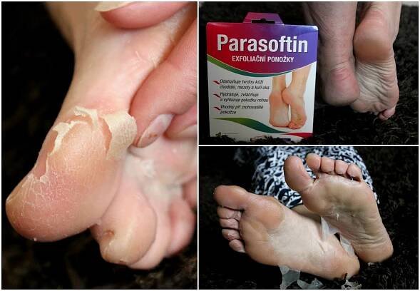 TEST: Exfoliačné ponožky Parasoftin - KAMzaKRASOU.sk
