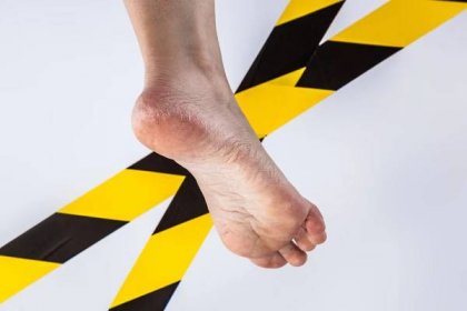 5 kroků k účinné léčbě plísní na nohou a prevenci opětovné infekce