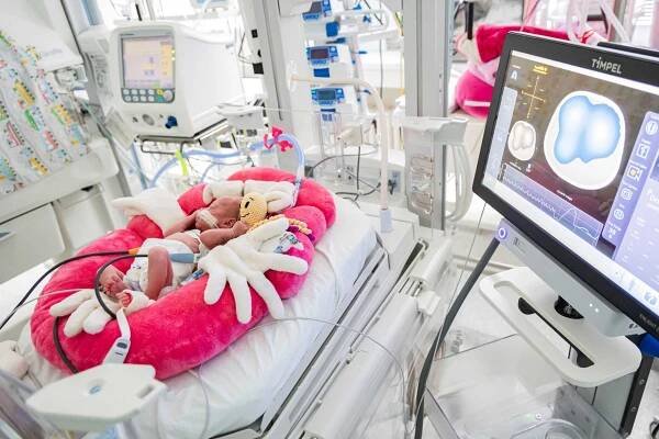 První v ČR! Zlínská neonatologie má monitor plicních funkcí, který dříve rozpozná patologie novorozenců - ZLIN.CZ