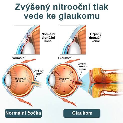 Oční kapky optifusion nano sérum – nanotechnologie obnovuje jasný zrak – Detzone Store