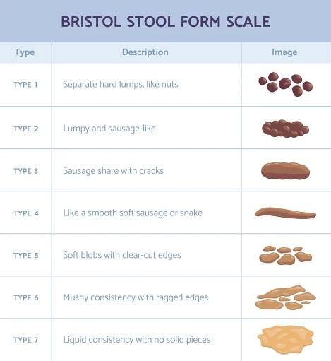 bristol stolice tvar měřítko infografika s výkaly typu ploché vektorové ilustrace. - výkal stock ilustrace