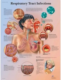 Schéma onemocnění dýchací soustavy - STELLA