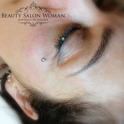 microdermal_pod_okem