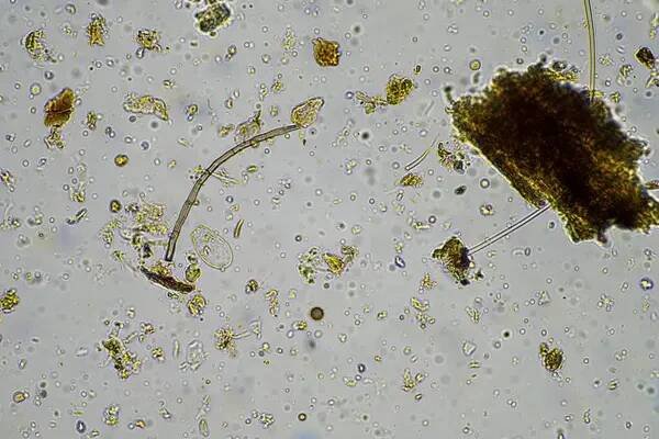 Půdní mikroorganismus pod mikroskopem recyklující živiny v kompostu na regenerační zemědělské farmě v Austrálii, na jaře vykazující amébu, plísně, houby, mikroby a háďátka — Stock obrázek