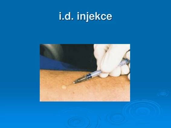 PPT - Injekce PowerPoint Presentation, free download - ID:3530800