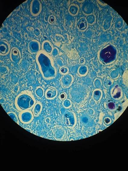 Mycobacterium