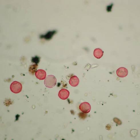Pollen microscoop.jpg