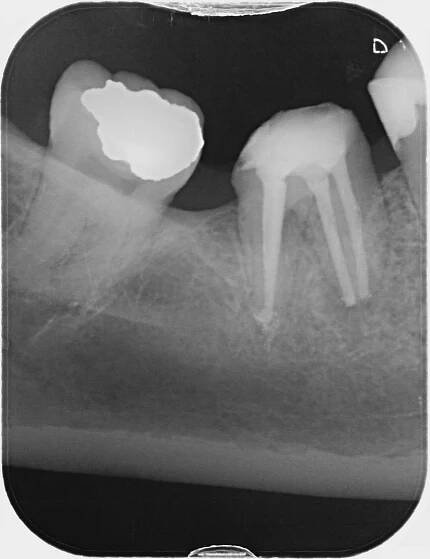 Dentální hygiena: jak probíhá a kolik stojí - Vitalia.cz