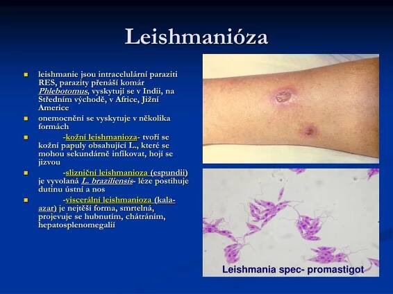 PPT - Etiologická patologie PowerPoint Presentation, free download - ID:5061351
