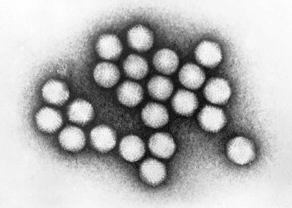 Adenovirus is normally harmless—here's why some outbreaks turn deadly