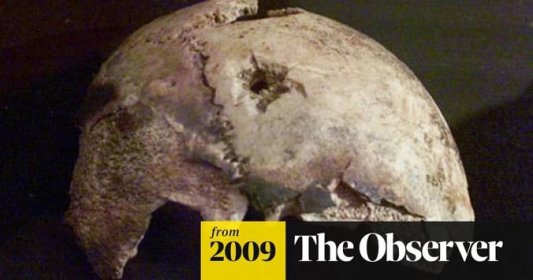 Tests on skull fragment cast doubt on Adolf Hitler suicide story