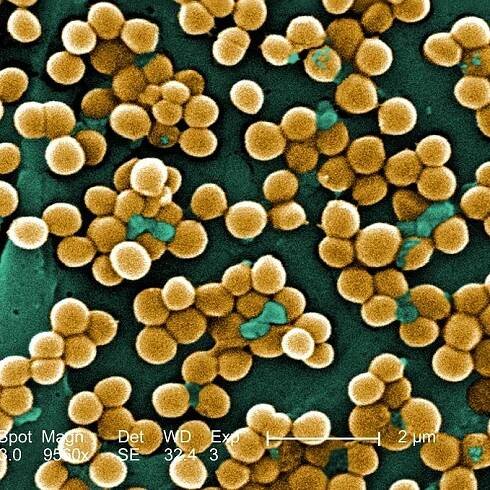 What Is MRSA?